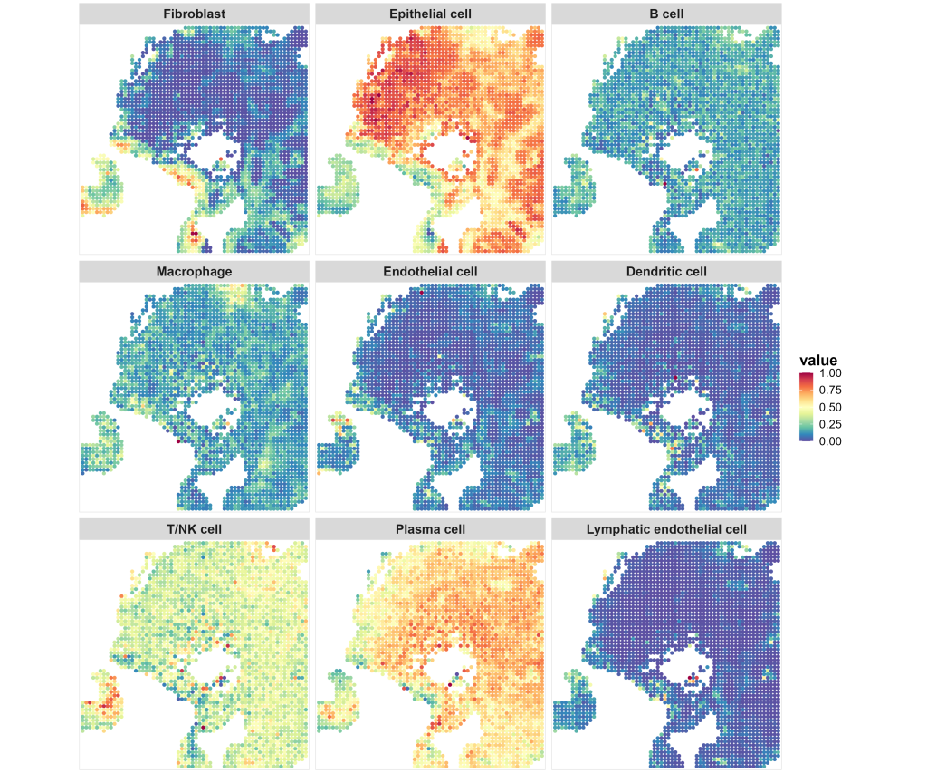 M20 Spatial Offers In-Depth Insights into Breast Cancer Spatial Heterogeneity